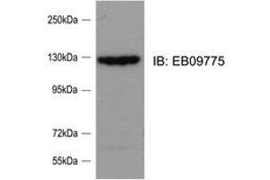 Western Blotting (WB) image for anti-SLIT-ROBO rho GTPase Activating Protein 2 (SRGAP2) (Internal Region) antibody (ABIN2464859) (SRGAP2 antibody  (Internal Region))