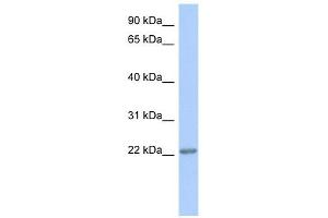 TRAPPC5 antibody used at 1 ug/ml to detect target protein.