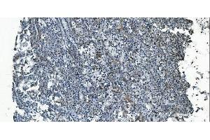 IHC analysis of MCU using anti-MCU antibody (ABIN7601931). (MCU antibody  (AA 51-351))