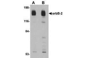 Western blot analysis of erbB-2 in rat liver tissue lysate with AP30319PU-N erbB-2 antibody at (A) 1 and (B) 2 μg/ml. (ErbB2/Her2 antibody  (C-Term))