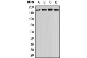 Western blot analysis of MYO3B expression in NCIH460 (A), HEK293T (B), mouse eye (C), rat kidney (D) whole cell lysates.