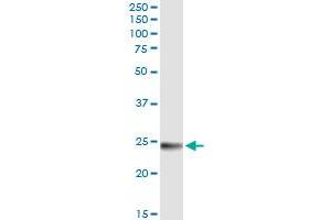 Immunoprecipitation of WISP2 transfected lysate using anti-WISP2 MaxPab rabbit polyclonal antibody and Protein A Magnetic Bead , and immunoblotted with WISP2 MaxPab mouse polyclonal antibody (B01) . (WISP2 antibody  (AA 1-250))