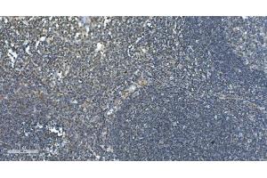 IHC analysis of LSM7 using anti-LSM7 antibody (ABIN7598937). (LSM7 antibody  (AA 1-103))