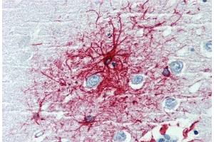 Immunohistochemistry staining of human brain cortex (paraffin-embedded sections) with anti-GFAP (clone GF-01). (GFAP antibody)