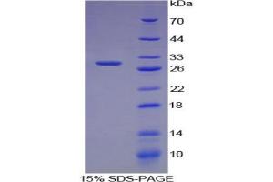 SDS-PAGE analysis of Human Chordin Protein.