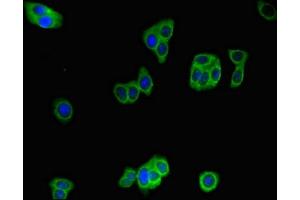 Immunofluorescent analysis of HepG2 cells using ABIN7156344 at dilution of 1:100 and Alexa Fluor 488-congugated AffiniPure Goat Anti-Rabbit IgG(H+L) (IDE antibody  (AA 501-800))