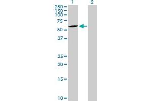Western Blot analysis of CERCAM expression in transfected 293T cell line by CERCAM MaxPab polyclonal antibody. (CERCAM antibody  (AA 1-517))