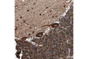 Immunohistochemical staining of human cerebellum with GPSM2 polyclonal antibody  shows strong cytoplasmic positivity in Purkinje cells in molecular layer and granular layer at 1:500-1:1000 dilution. (GPSM2 antibody)