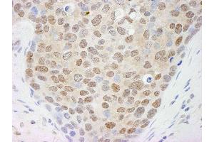 Immunohistochemistry (IHC) image for anti-Cullin 4A (CUL4A) (C-Term) antibody (ABIN7448505)