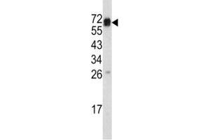 Western blot analysis of CD105 antibody and mouse heart tissue lysate
