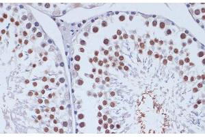 Immunohistochemistry of paraffin-embedded Rat testis using DNMT3L Polyclonal Antibody at dilution of 1:100 (40x lens). (DNMT3L antibody)