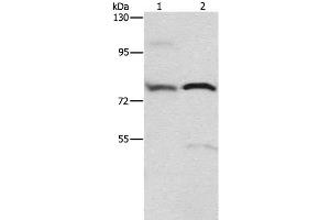 Western Blot analysis of 293T cell and Human fetal brain tissue using ATXN1 Polyclonal Antibody at dilution of 1:800 (Ataxin 1 antibody)