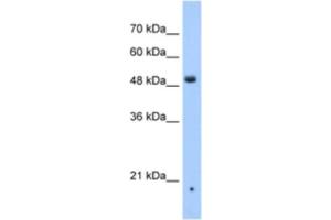 Western Blotting (WB) image for anti-Zinc Finger, DHHC-Type Containing 16 (ZDHHC16) antibody (ABIN2463313) (ZDHHC16 antibody)