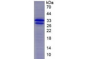 SDS-PAGE (SDS) image for Superoxide Dismutase 3, Extracellular (SOD3) (AA 25-251) protein (His tag) (ABIN1080870)