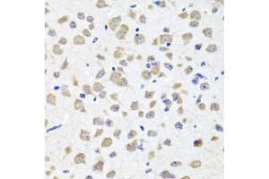 Immunohistochemistry of paraffin-embedded mouse brain using PIP4K2B antibody at dilution of 1:100 (x40 lens).