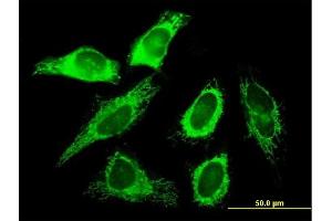 Immunofluorescence of purified MaxPab antibody to SLC25A3 on HeLa cell. (SLC25A3 antibody  (AA 1-361))