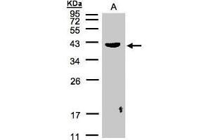 WB Image Sample(30 μg of whole cell lysate) A:Raji, 12% SDS PAGE antibody diluted at 1:500 (Pleckstrin antibody  (C-Term))