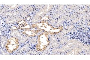 Immunohistochemistry (IHC) image for anti-Matrix Metalloproteinase 2 (MMP2) (AA 110-660) antibody (ABIN7438181)