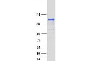 Validation with Western Blot (EPB41 Protein (Transcript Variant 2) (Myc-DYKDDDDK Tag))