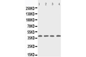 Anti-p53R2 antibody, Western blotting Lane 1: Rat Thymus Tissue Lysate Lane 2: MCF-7 Cell Lysate Lane 3: A431 Cell Lysate Lane 4: HELA Cell Lysate (RRM2B antibody  (C-Term))