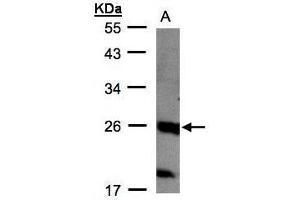 WB Image Sample(30 μg of whole cell lysate) A:MOLT4, 12% SDS PAGE antibody diluted at 1:1000 (C1orf57 antibody  (C-Term))