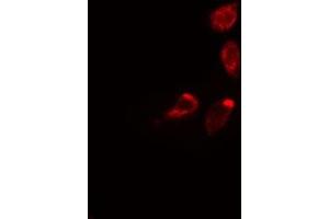 ABIN6275307 staining 293 cells by IF/ICC. (Septin 3 antibody  (Internal Region))