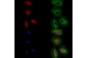 ABIN6256860 and ABIN6274329 staining  cells by IF/ICC.