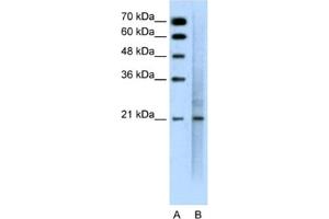 Western Blotting (WB) image for anti-Mucin 1 (MUC1) antibody (ABIN2462410) (MUC1 antibody)