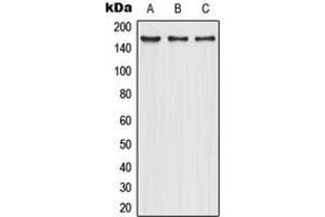 Western blot analysis of CD206 expression in HepG2 (A), Caco2 (B), NIH3T3 (C) whole cell lysates.