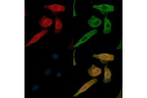 Phospho-IL4R/CD124 (Tyr497) Antibody staining A549 cells(H2O2 treatment) by IF/ICC.