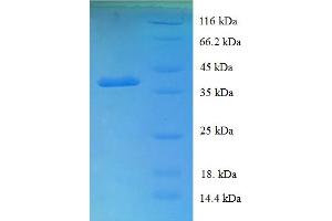 SDS-PAGE (SDS) image for UBX Domain Protein 11 (UBXN11) (AA 38-146), (partial) protein (GST tag) (ABIN5709169) (UBXN11 Protein (AA 38-146, partial) (GST tag))