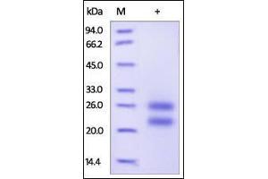 Human CD69, His Tag on SDS-PAGE under reducing (R) condition.
