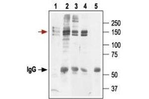Immunoprecipitation of KV11. (KCNH2 antibody  (Extracellular))