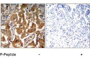 Image no. 1 for anti-Adducin 1 (Alpha) (ADD1) (pSer726) antibody (ABIN196918) (alpha Adducin antibody  (pSer726))