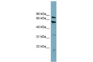CPT1B antibody used at 1 ug/ml to detect target protein. (CPT1B antibody)