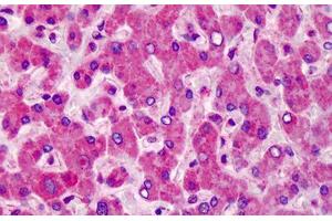 Human Liver: Formalin-Fixed, Paraffin-Embedded (FFPE) (MCTP1 antibody  (C-Term))