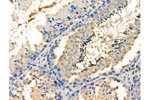 Phospho-PPP1CA (Thr320) Antibody at 1/100 staining Mouse testis tissue by IHC-P.