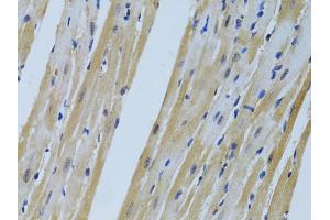 Immunohistochemistry of paraffin-embedded mouse heart using FHL2 antibody (ABIN1872694) at dilution of 1:100 (40x lens). (FHL2 antibody)