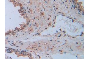 Used in DAB staining on fromalin fixed paraffin- embedded kidney tissue (KIF5A antibody  (AA 473-605))