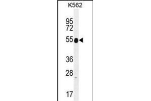 KRT25 Antibody (C-term) (ABIN655199 and ABIN2844814) western blot analysis in K562 cell line lysates (35 μg/lane). (Keratin 25 antibody  (C-Term))