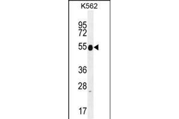 Keratin 25 antibody  (C-Term)