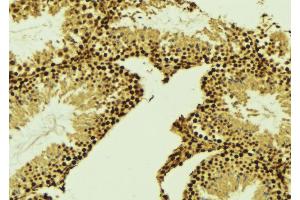 ABIN6269000 at 1/100 staining Mouse testis tissue by IHC-P. (Cyclin E2 antibody  (C-Term))