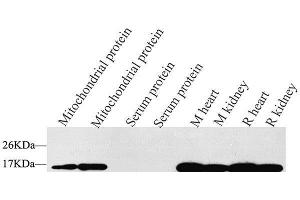 Western Blot analysis of various samples using COX4I1 Polyclonal Antibody at dilution of 1:1500. (COX IV antibody)