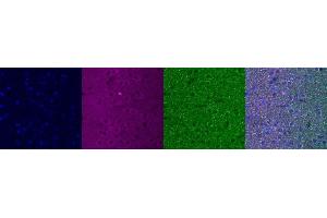 Immunohistochemistry (IHC) image for anti-Insulin-Like Growth Factor Binding Protein 6 (IGFBP6) antibody (ABIN7456279) (IGFBP6 antibody)