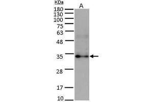 WB Image Sample (15 ug of whole cell lysate) A: HUVEC antibody diluted at 1:5000 (FGF10 antibody)