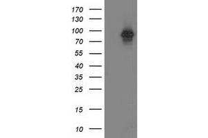 Western Blotting (WB) image for anti-Protein Kinase C, epsilon (PRKCE) antibody (ABIN1500232) (PKC epsilon antibody)