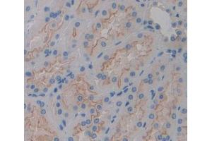 Used in DAB staining on fromalin fixed paraffin- embedded kidney tissue (PLCH2 antibody  (AA 1-257))