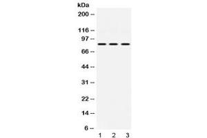 Western blot testing of 1) rat heart, 2) mouse NIH 3T3 and 3) human HeLa lysate with KRIT1 antibody at 0. (KRIT1 antibody  (AA 703-736))