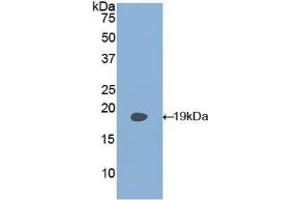 Detection of Recombinant PLAA, Human using Polyclonal Antibody to Phospholipase A2 Activating Protein (PLAP)