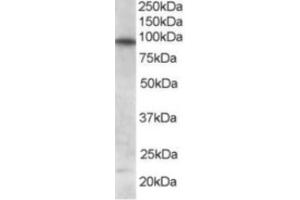 Western Blotting (WB) image for anti-Forkhead Box O3 (FOXO3) (C-Term) antibody (ABIN2465213) (FOXO3 antibody  (C-Term))